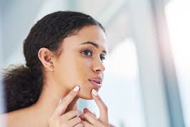 Blocks acne triggers & promotes healthy cell growth. How To Get Rid Of Pimples Fast Quick Ways To Eliminate Zits Acne