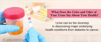 What Does The Color And Odor Of Your Urine Say Your Health