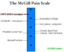 Pin On Rsd Crps Ii