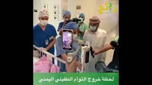 الطفلة منار , فيديو للطفلة منار قبل عملية فصل التؤأم الطفيلي. Q4xxr7vypk2rm
