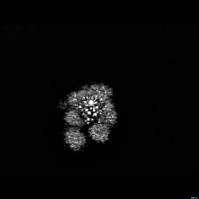 The best gifs of extraction on the gifer website. How To Extract Frames From A Gif File Preserving Frame Dimensions Stack Overflow