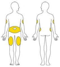 Farxiga may cause serious side effects including: Trulicity Bulasmed