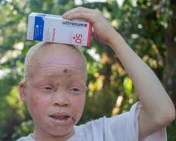 Skin cancer is not common in children, however, the incidence of melanoma in children is increasing by 2 percent each year. Skin Cancer Prevention Treatment Advantage Africa