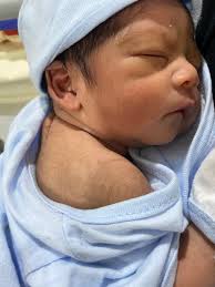 Normal delivery of baby