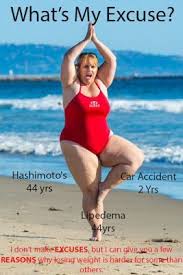 The Well Rounded Mama Size Acceptance Warrior Birth Activist And One Fierce Mama Home About This Blog Terminology Cesare Lipedema Lymphedema Leg Lymphedema