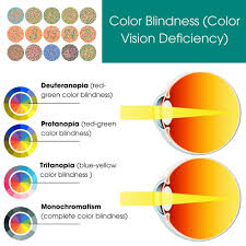 Image result for Color Blindness