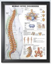 Human Spine Disorders Chart 20x26 Human Anatomy Chart