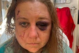 Fundraiser by Barbara Boyd : Support Niece's Healing and New Home Journey