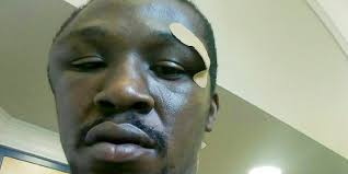 Asheville to pay pedestrian in police beating $650,000