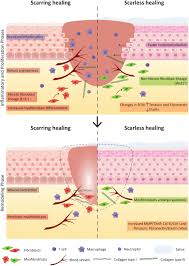 Image result for Wound Repair
