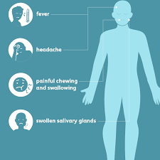 It usually happens in childhood. Mumps Signs Symptoms And Complications