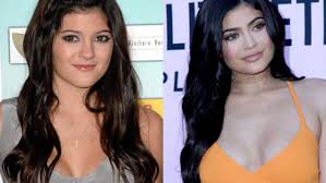 Kylie jenner was born on august 10, 1997 in los angeles, california to kris jenner (née kristen kylie has one full sibling, kendall jenner. Stars Die Eine Krasse Optische Veranderung Durchmachten