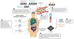 How to get a home test kit. Grail And The Quest For Earlier Multi Cancer Detection