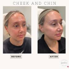 DESIREE MOSER, RN (@injector_desiree) • Instagram फोटोहरू र भिडियोहरू