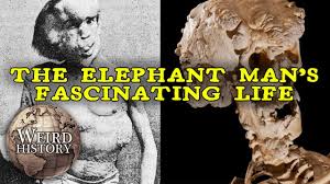 We did not find results for: The Elephant Man The Weird Tragic Story Of Joseph Merrick Youtube