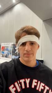 Cauliflower ear its finest✨, ., ., .,  #cauliflower#cauliflowerear#wrestling#judo#bjj#mma#combatsport#tough#painful#recovery#combat#hardwork#athlete