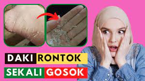 Demi penampilan, cek cara menghilangkan uban secara permanen dan alami. Cara Hilangkan Daki Di Kaki Putih Hanya 5 Menit Cara Menghilangkan Sel Kulit Youtube