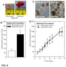 What causes a squamous cell carcinoma? Plos One Identification Of A Population Of Epidermal Squamous Cell Carcinoma Cells With Enhanced Potential For Tumor Formation