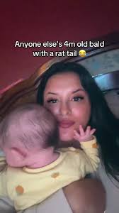 4 Month Old Bald Spot