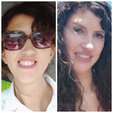 The reveal!! 🎉 15 months made such a big difference! A couple more teeth  still need to come in, but loving this smile!! 😁 🥰 Check out the before  pictures!! How many