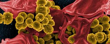 Auch die dekolonisation von mrsa auf wunden ist damit möglich. Mrsa Und Das Massnahmen Marchen Doccheck