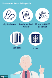 Image result for Rheumatoid Factor