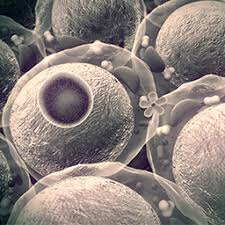 Toda la información sobre sus causas, síntomas, tratamiento. El Cancer Y La Diabetes Mas Relacionados De Lo Que Se Cree
