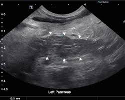 A cancer diagnosis for your dog is heartbreaking and often overwhelming. The Role Of Imaging In Diagnosing Pancreatitis Mspca Angell