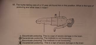 Image result for Decorticate Posturing