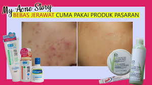 Ini dia produk pencuci muka dari hada labo. Menghilangkan Jerawat Dengan Produk Hada Labo Bisa Lia Harahap