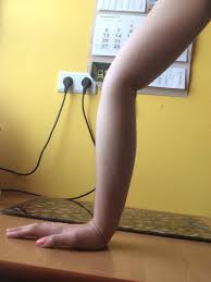 Choroba przebiega w różny sposób, od stanów lekkich po bardzo ciężkie, uniemożliwiające normalne funkcjonowanie. Zostalam Wrzucona Na Czarna Przez Opa We Wpisie Hannahalla Wykop Pl