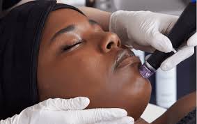 HydraFacial in Calabasas