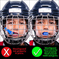 Safety is and has always been considered a shared responsibility among  Trainers, Coaches, Officials, Parents and Players in the #OMHA. Everyone  has a role to play in ensuring safety for all our