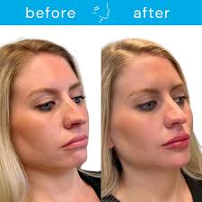 Lewisburg Plastic Surgery