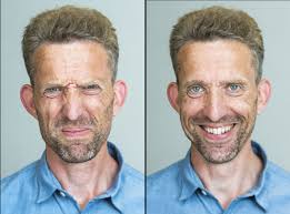 Immune cells are behind the depression experienced in inflammation