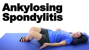 ankylosing spondylitis stretches