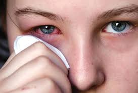 Pertumbuhan kulit di depan telinga; Hilangkan Sakit Mata Disebabkan Alergi Atau Bakteria Dengan 10 Cara Tradisional Maskulin