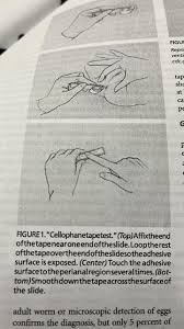 Image result for Pinworm Test