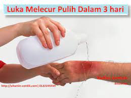 Benarkah krim ini memang sesuai untuk kulit bayi? Luka Melecur Pulih Dalam 3 Hari Vitamin Cerdik By Coach Anah Ahmad