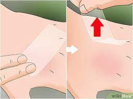 Protects your pet and helps prevent eggs hatching in. How To Treat A Caterpillar Sting 11 Steps With Pictures