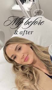 Daniele Laser and Aesthetics Leah