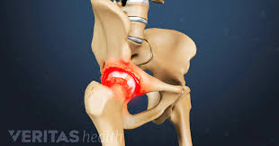 We did not find results for: Clinical Symptoms Of Bone Spurs