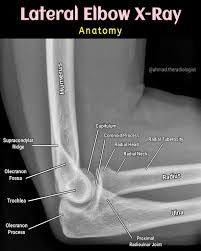Image result for Elbow XRay