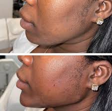 vanitymedspa) • Instagram photos and videos