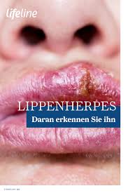 Pin Auf Deine Haut Hauttypen Gesundheits Wellnesstipps