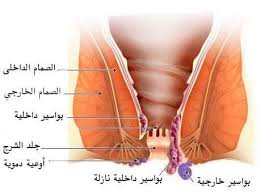 العلاج الطبيعي للشرخ الشرجي لحن الحياة