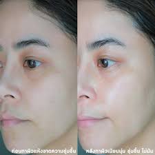 ครีมภูเขา ฟูจิ เฮเซล ครีม สโนว์ เอ็กซ์ มอยเจอร์ไรซิ่ง ครีม HAZEL CREAM SNOW  (EX) MOISTURISING CREAM