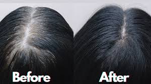 A diet that's rich in antioxidants can reduce oxidative stress. Which Vitamins Reverse Grey Hair It Really Works Vitamins