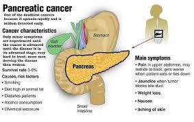 A single cancer cell grows and divides rapidly, becoming a tumor that doesn't go american cancer society: Sooner Or Later Three Kinds Of People Will Be Cancer King Pancreatic Cancer To Find Steemit