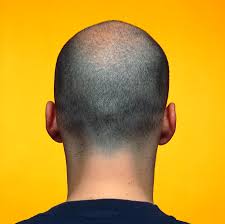 This is a classic mixed with a new age style. Rear View Of A Male Head With Very Short Hair Photograph By Alex Bartel Science Photo Library